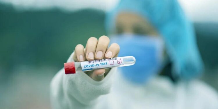 covid doktor hemsire test pozitif