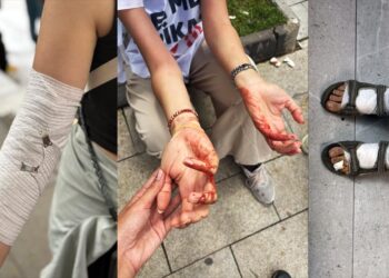 Öğretmenler yaralanan eğitimcilerin görüntülerini paylaştı